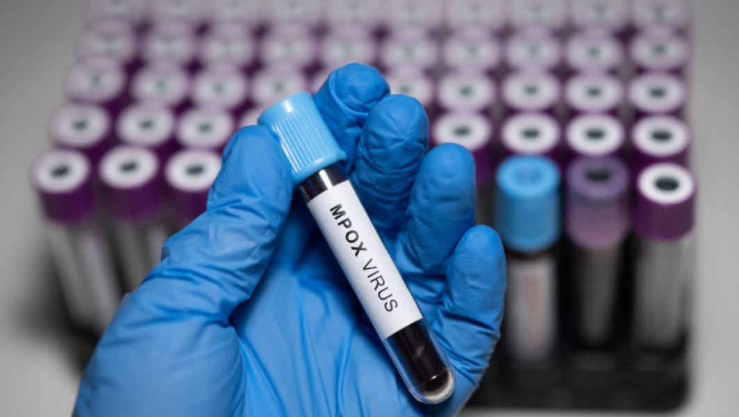 Prim caz de infectie cu noua varianta a virusului mpox confirmat în Germania
