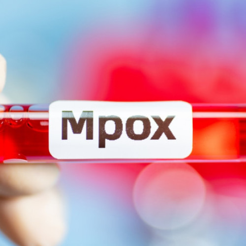 Epidemia de mpox, declarată urgență de sănătate publică de către OMS