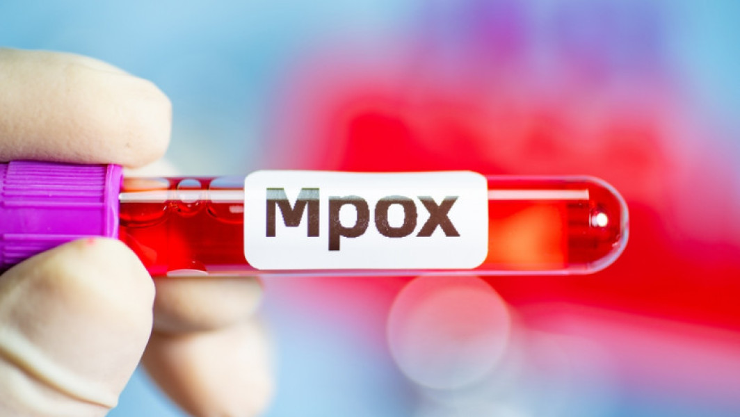 Epidemia de mpox, declarată urgență de sănătate publică de către OMS
