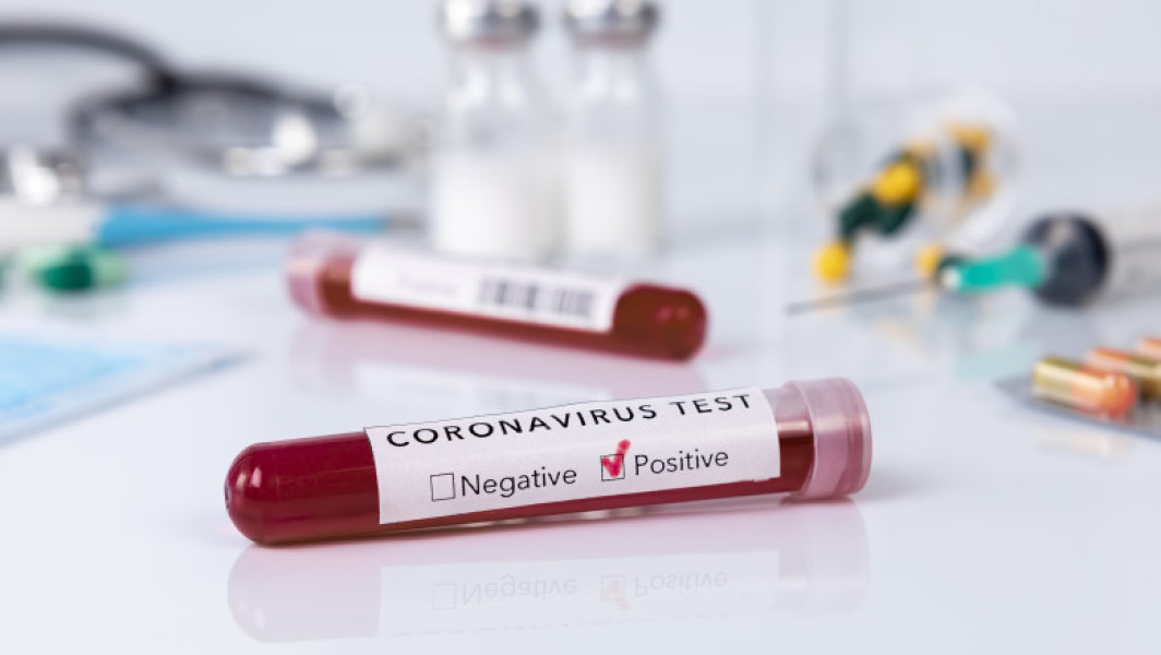 CIA consideră că originea COVID-19 ar putea fi legată de un laborator