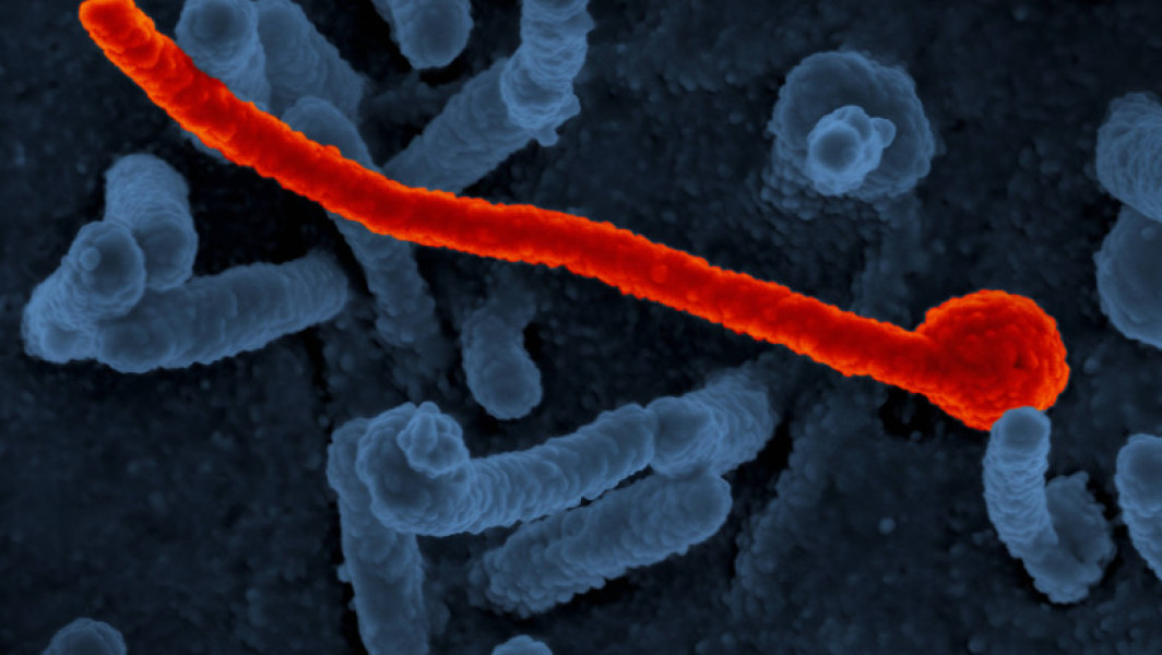 Focar de Ebola confirmat în Kampala, Uganda