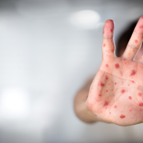 Comitetul consultativ din SUA modifică recomandările pentru vaccinarea copiilor sub patru ani