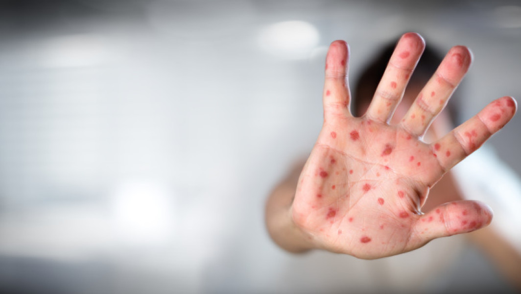 Comitetul consultativ din SUA modifică recomandările pentru vaccinarea copiilor sub patru ani